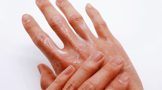 Soapy hands
